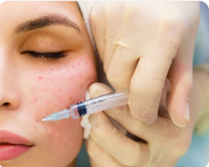 aiguille montée sur une seringue